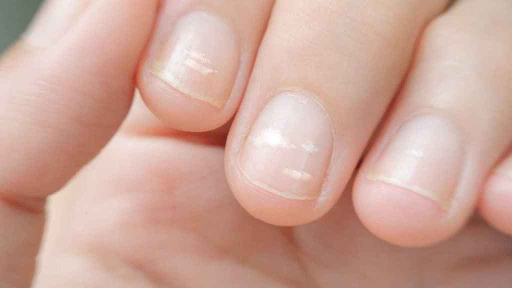 cobertura Florecer fenómeno Las 10 señales en tus uñas que indican que algo funciona mal en tu organismo