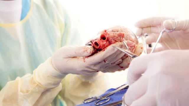 España, líder en trasplantes y en la lucha contra la trata de seres humanos para el tráfico de órganos