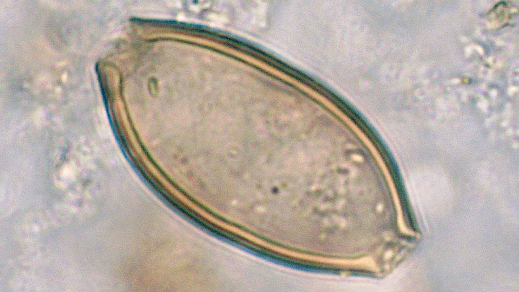 Imagen a vista de microscopio de un huevo del parásito documentado en el interior del recipiente cerámico.