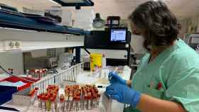 Servicio de Microbiología realizando las determinaciones serológicas de HIV.