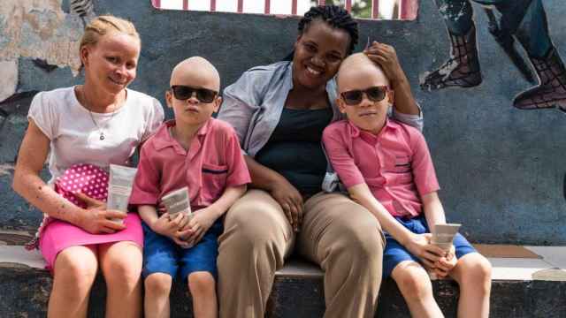 Altruist, la crema que ayuda a los albinos africanos y reduce la incidencia del cáncer de piel