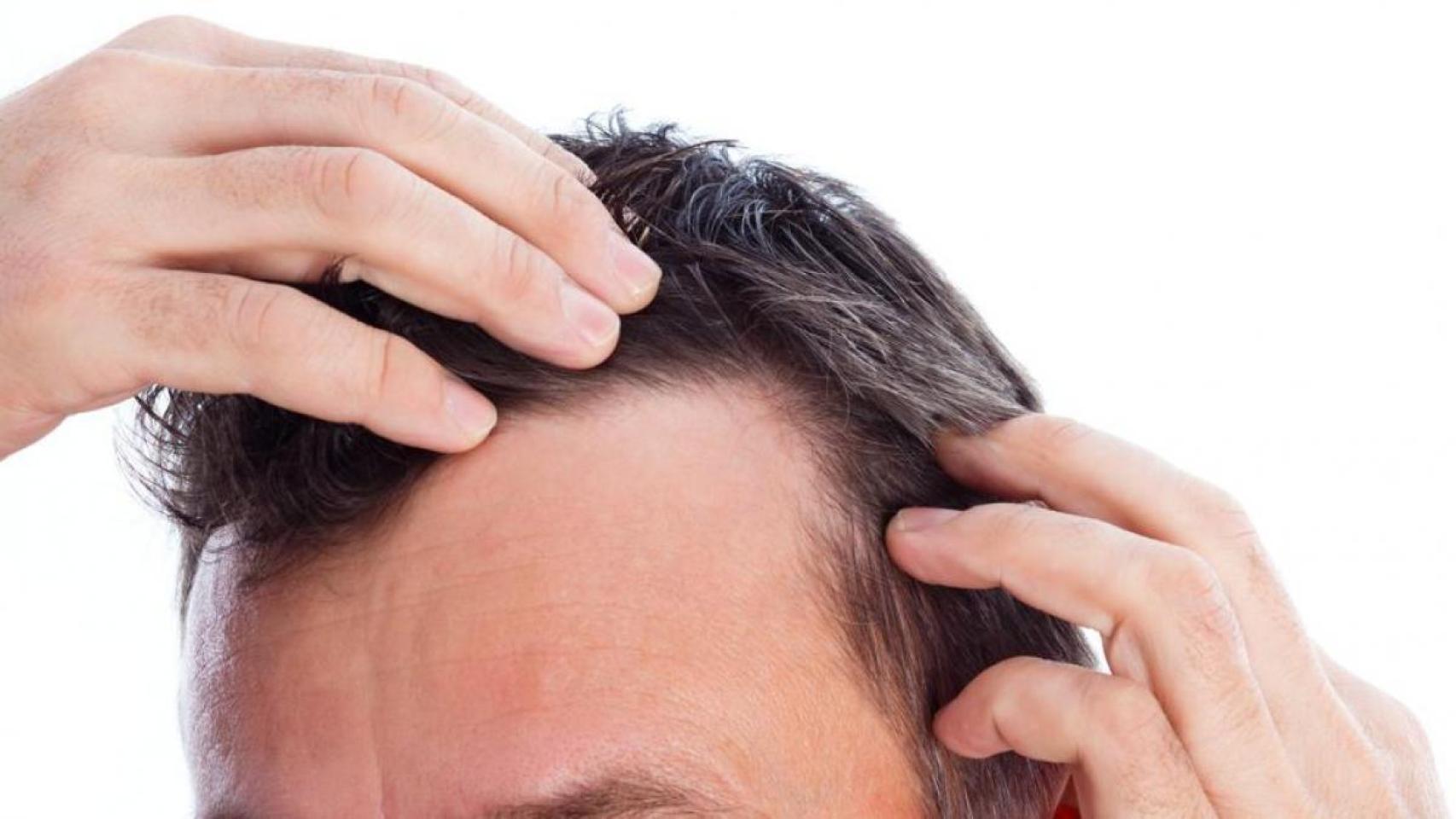 Estas son 6 fundamentales para evitar la caída del pelo: cómo obtenerlas
