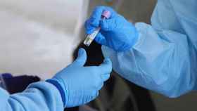 Una enfermera da una muestra de PCR para su análisis durante la realización de PCR.