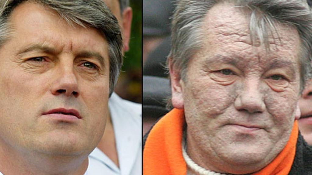 Viktor Yushchenko, antes y después de su envenenamiento.