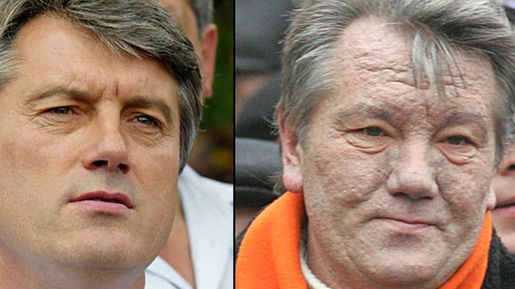 Viktor Yushchenko, antes y después de su envenenamiento.