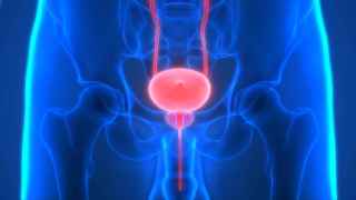 Los especialistas advierten de que los símtomas de tumor en la próstata solo se dan en estados avanzados
