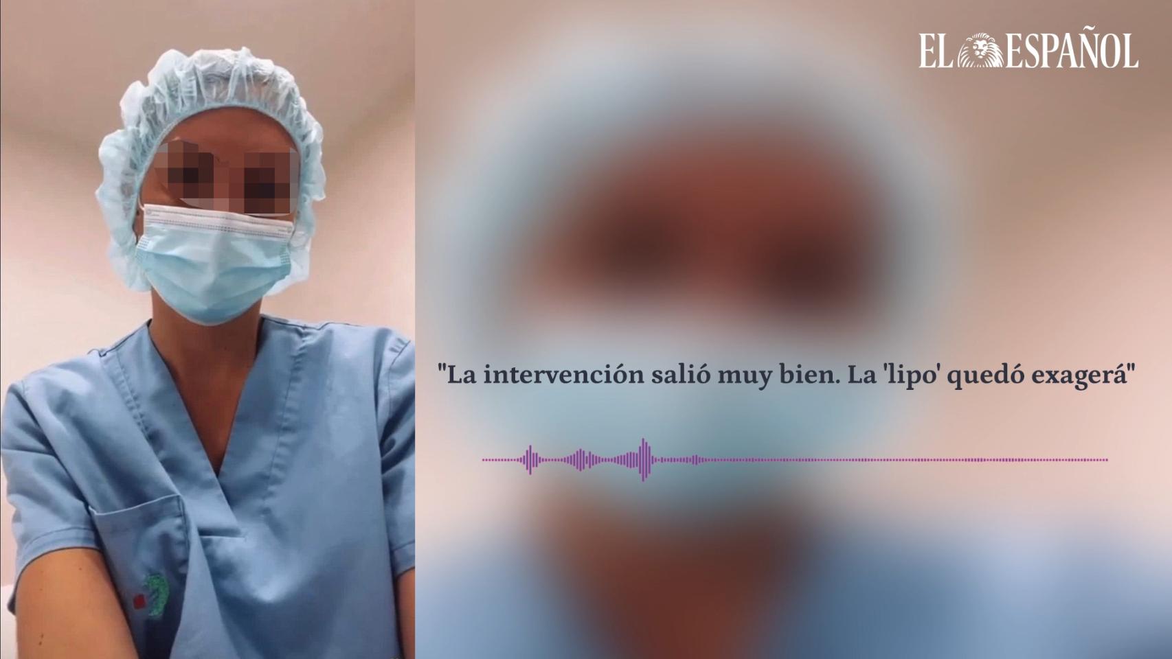 La intervención salió muy bien. La 'lipo' quedó exagerá