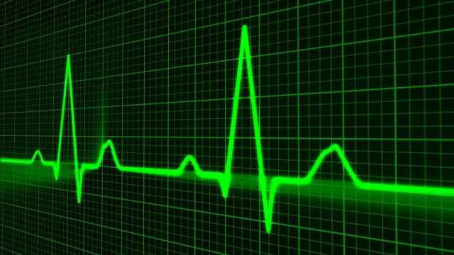 Gráfico de un electrocardiograma. IMAGEN: Pixabay.