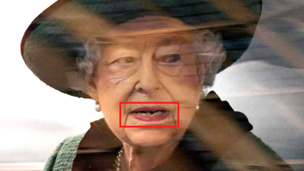 The queen showed severe crowding in the area under her teeth.