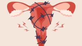 En la actualidad, no hay una forma objetiva de medir el dolor menstrual.