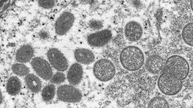 Imagen microscópica de la viruela del mono obtenida del brote de 2003 en EEUU. Cynthia S. Goldsmith, Russell Regnery/CDC