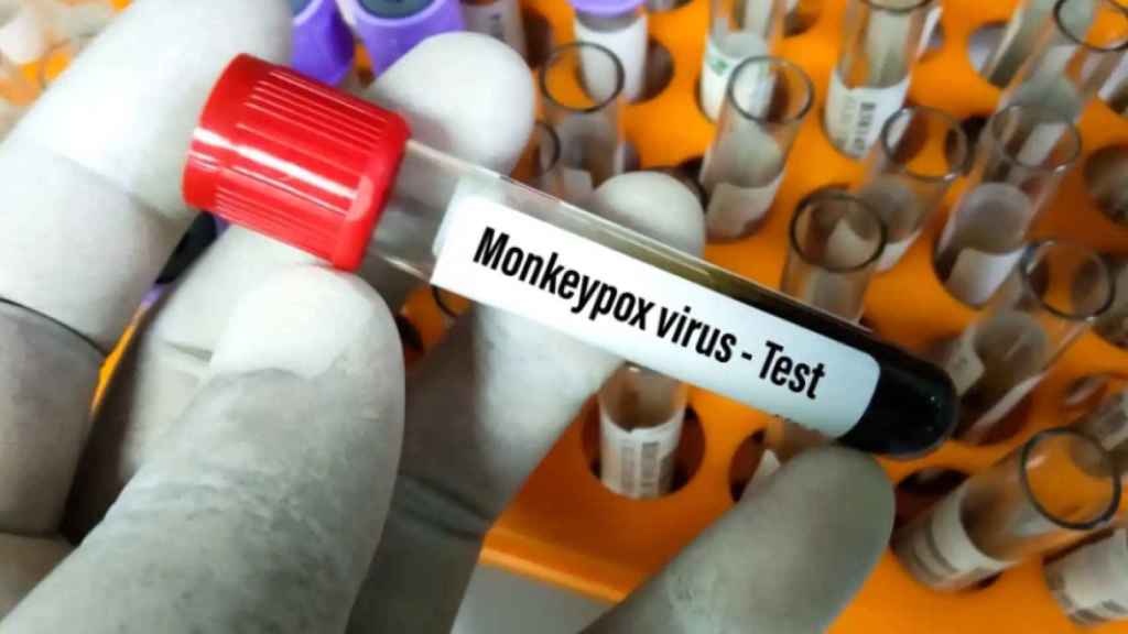 Test de la viruela del mono.