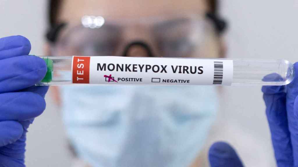 Muestras de virus de la viruela del mono. REUTERS/Dado Ruvic.