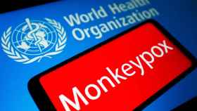 La OMS alerta sobre la viruela del mono.