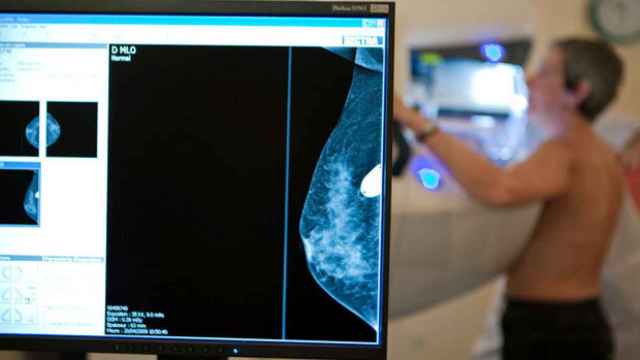 Imagen de archivo de la realización de una mamografía.