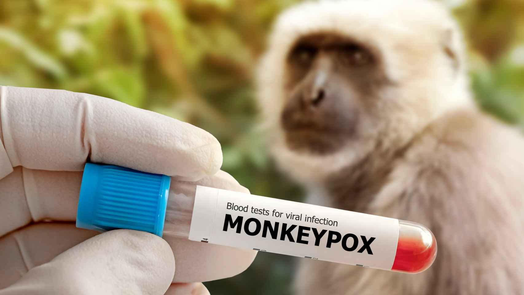 Imagen de archivo de la viruela del mono.