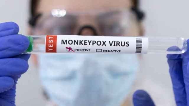 Muestras de virus de la viruela del mono. REUTERS/Dado Ruvic.
