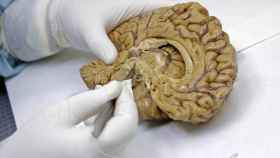 Un factor de riesgo para la enfermedad de Alzhéimer podría tener su origen, no en la cabeza, sino en el hígado.