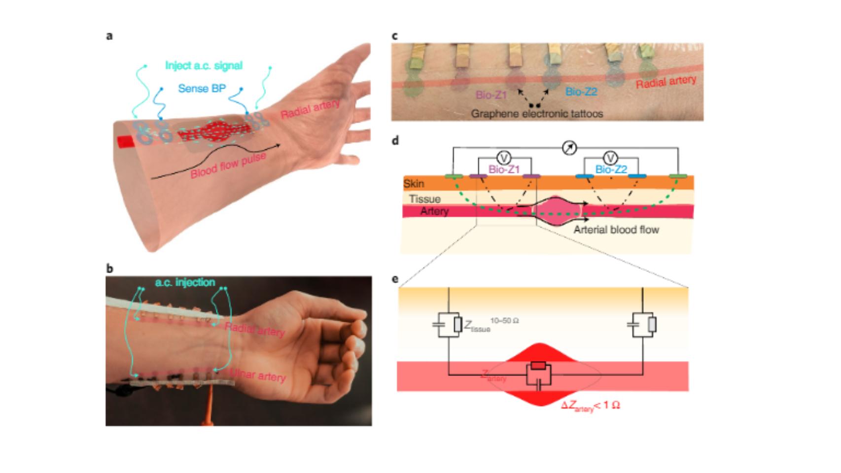 Un tatuaje electrónico mide la presión arterial de forma continua y sin  depender de máquinas