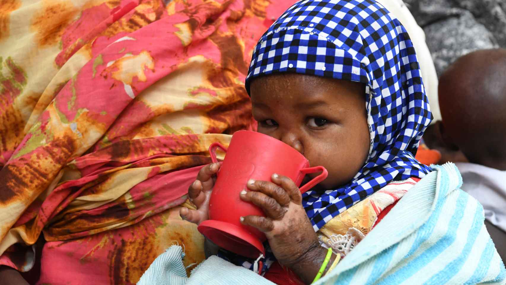 UNICEF alerta: la hambruna mundial podría acabar 49 millones de personas