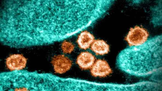 Partículas del virus del SARS-CoV-2 emergiendo de la superficie de células cultivadas en laboratorio.