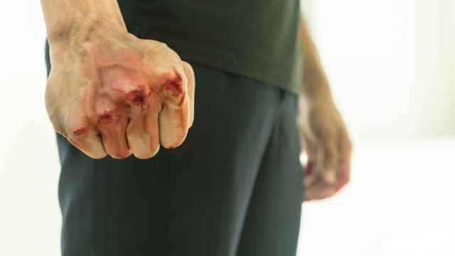 Imagen de archivo: el puño ensangrentado de un hombre después de una pelea.
