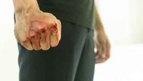 Imagen de archivo: el puño ensangrentado de un hombre después de una pelea.