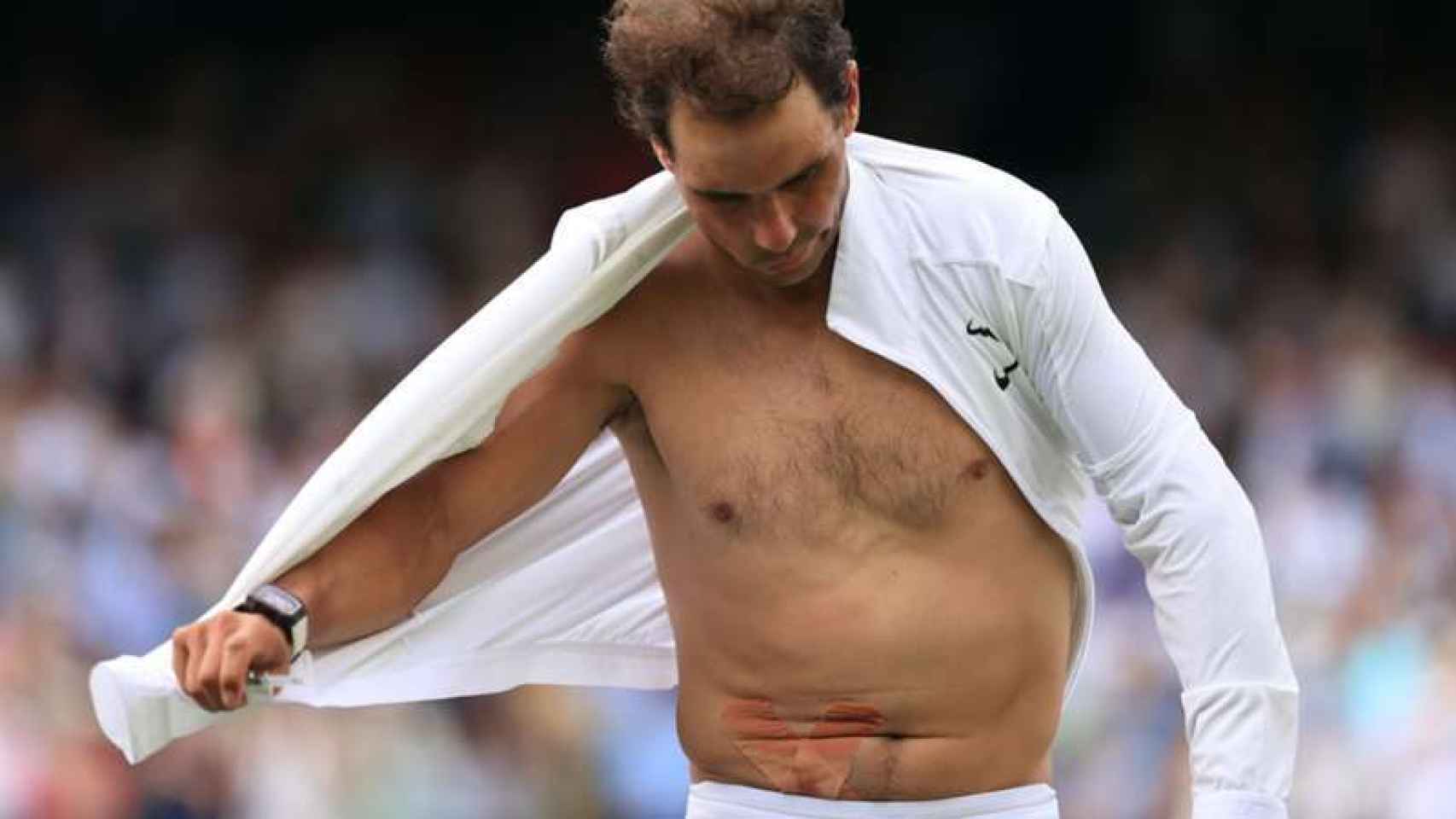 Así es la lesión de Rafa Nadal en el abdomen que le ha obligado a retirarse en Wimbledon thumbnail