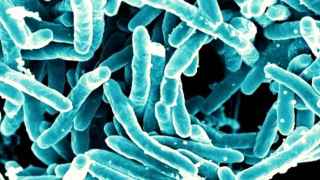 La bacteria responsable de la tuberculosis, una enfermedad con baja incidencia pero alta transmisión en la Comunidad Valenciana.