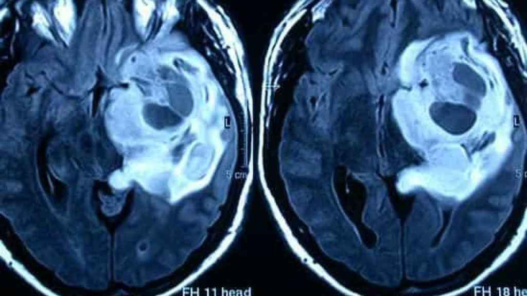 Imagen de un escáner cerebral.