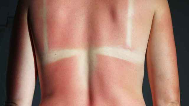 Consejos para quitar las marcas del bikini por el sol.