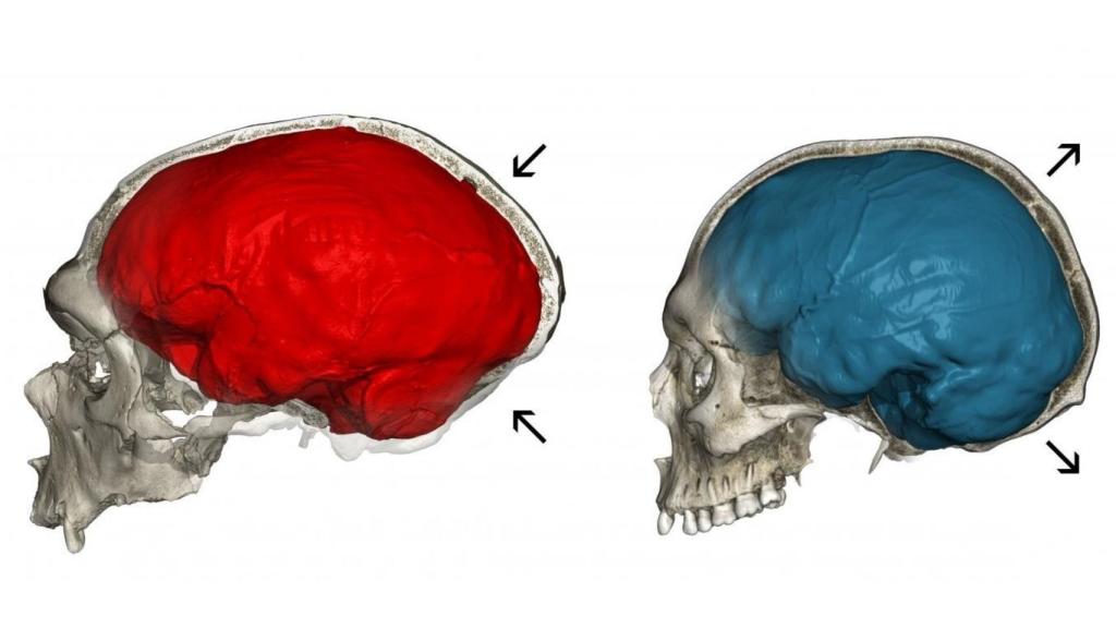 Una única mutación permitió al Homo sapiens generar más neuronas y