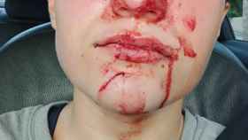 La menor de 15 años publicó esta y otras imágenes de la supuesta agresión en sus redes sociales.