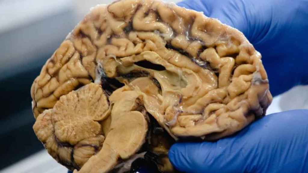 Un investigador sosteniendo un cerebro.