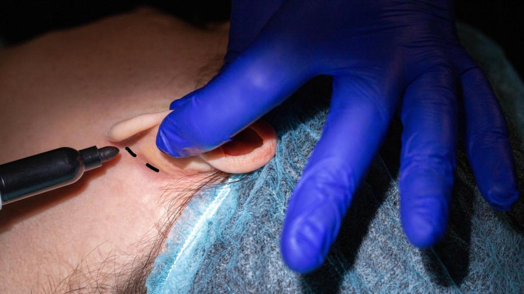 Una persona sometiéndose a una otoplastia.
