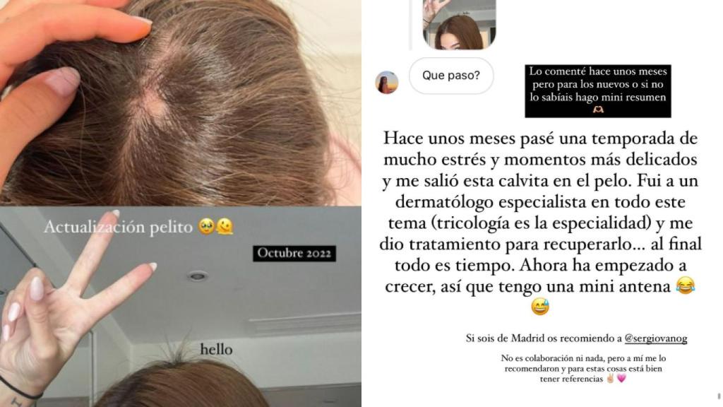 El dermatólogo especialista en alopecia que ha ayudado a Laura Escanes recuperar el pelo crisis de estrés