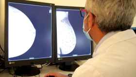 Un especialista revisando una mamografía.