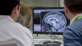 Dos médicos especialistas mirando la imagen de un cerebro.