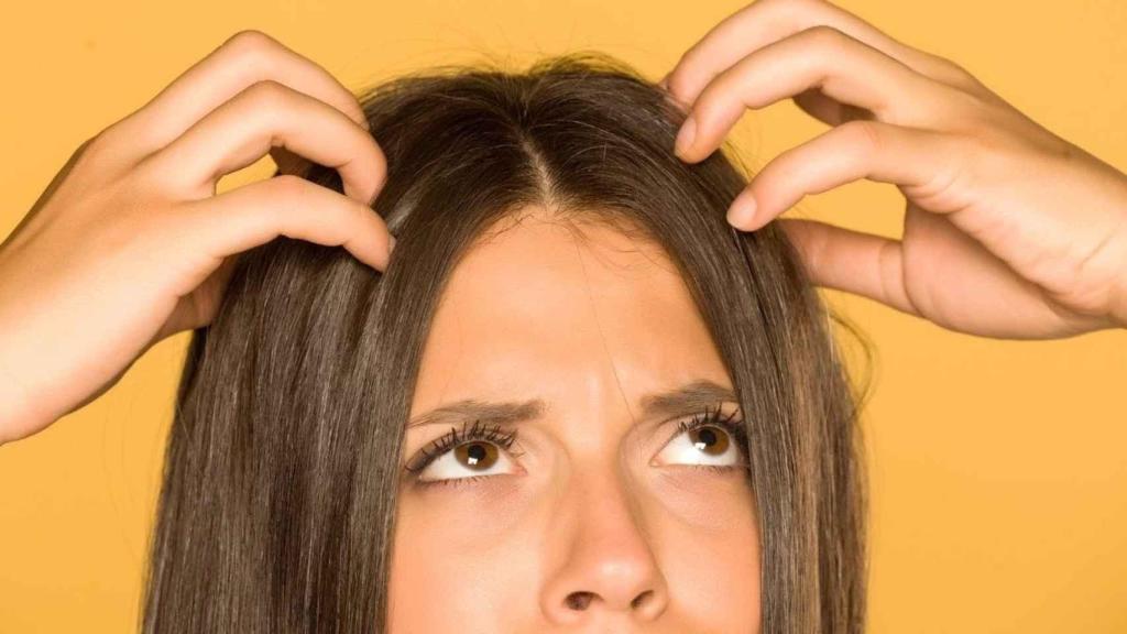 La dermatitis seborreica es una patología de carácter crónico.