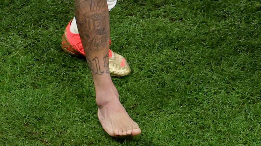 Imagen del tobillo de Neymar, inflamado en el Brasil - Serbia