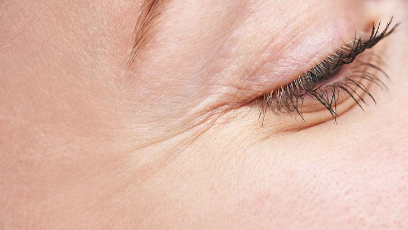 Facilitar fractura principio Remedios caseros para eliminar las arrugas bajo los ojos en menos de una  semana