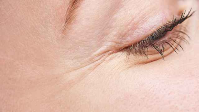 Cómo eliminar las arrugas bajo los ojos en menos de una semana (remedios caseros).