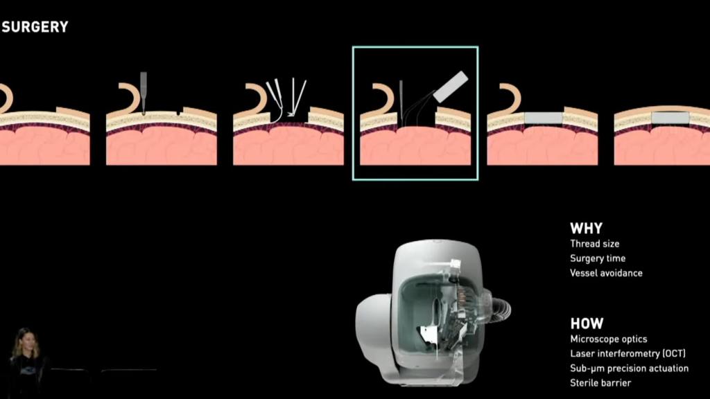 Proceso de implante de Neuralink