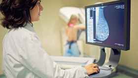 Médico revisando una radiografía de una mama