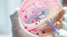 Una placa de Petri con un cultivo de bacterias intestinales.