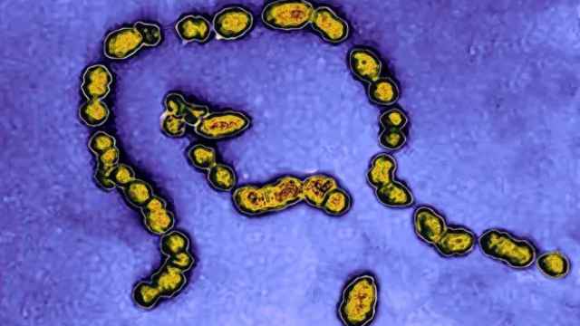 El estreptococo A es una infección bacteriana que puede llegar a ser muy grave.
