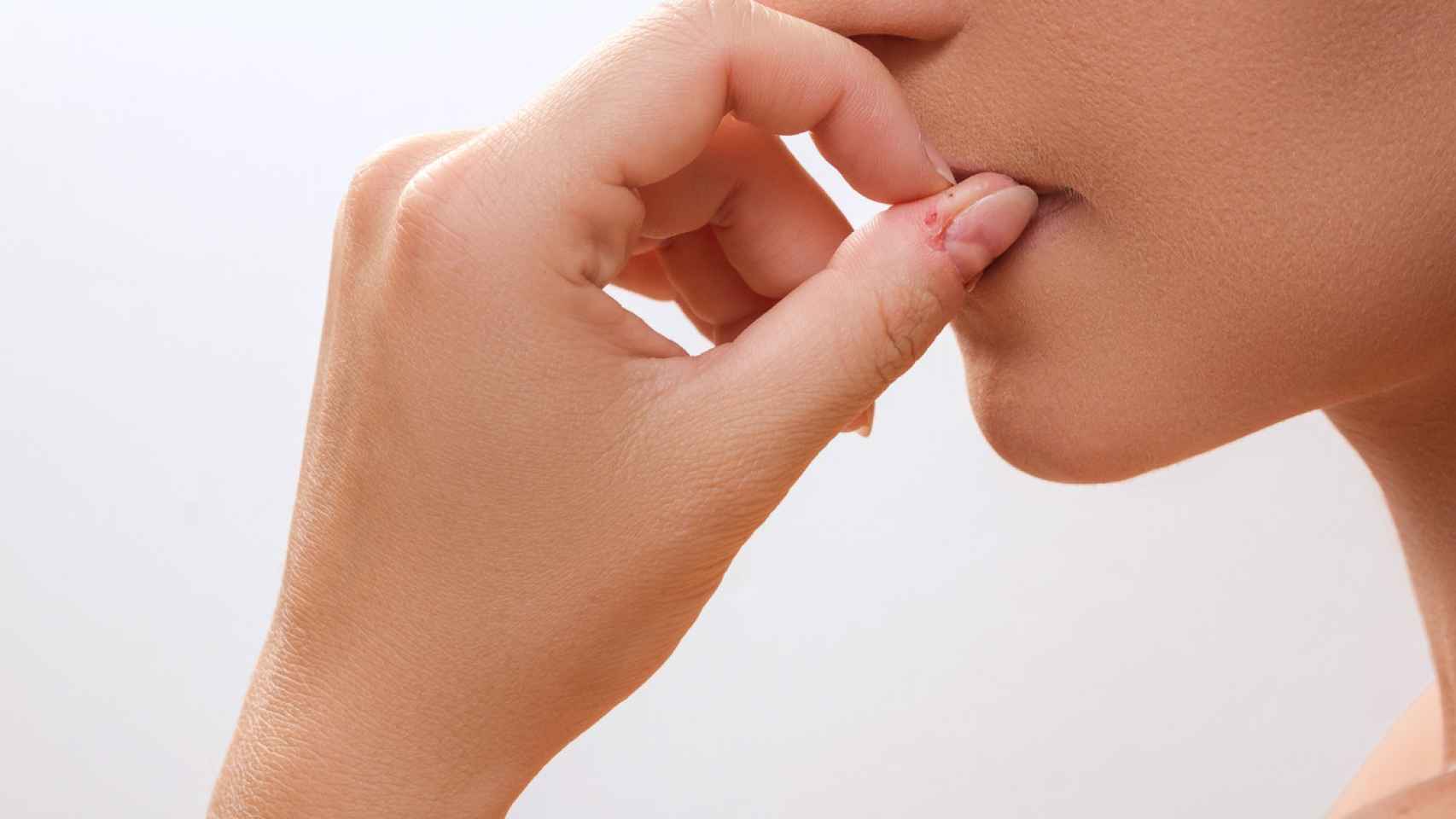 valor Enriquecer Fuerza Por qué te muerdes las uñas? Onicofagia, el trastorno detrás de este hábito  compulsivo