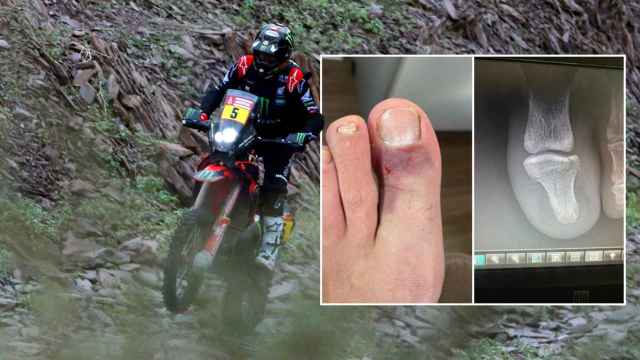 Joan Barreda corriendo en el Rally Dakar con un dedo del pie roto