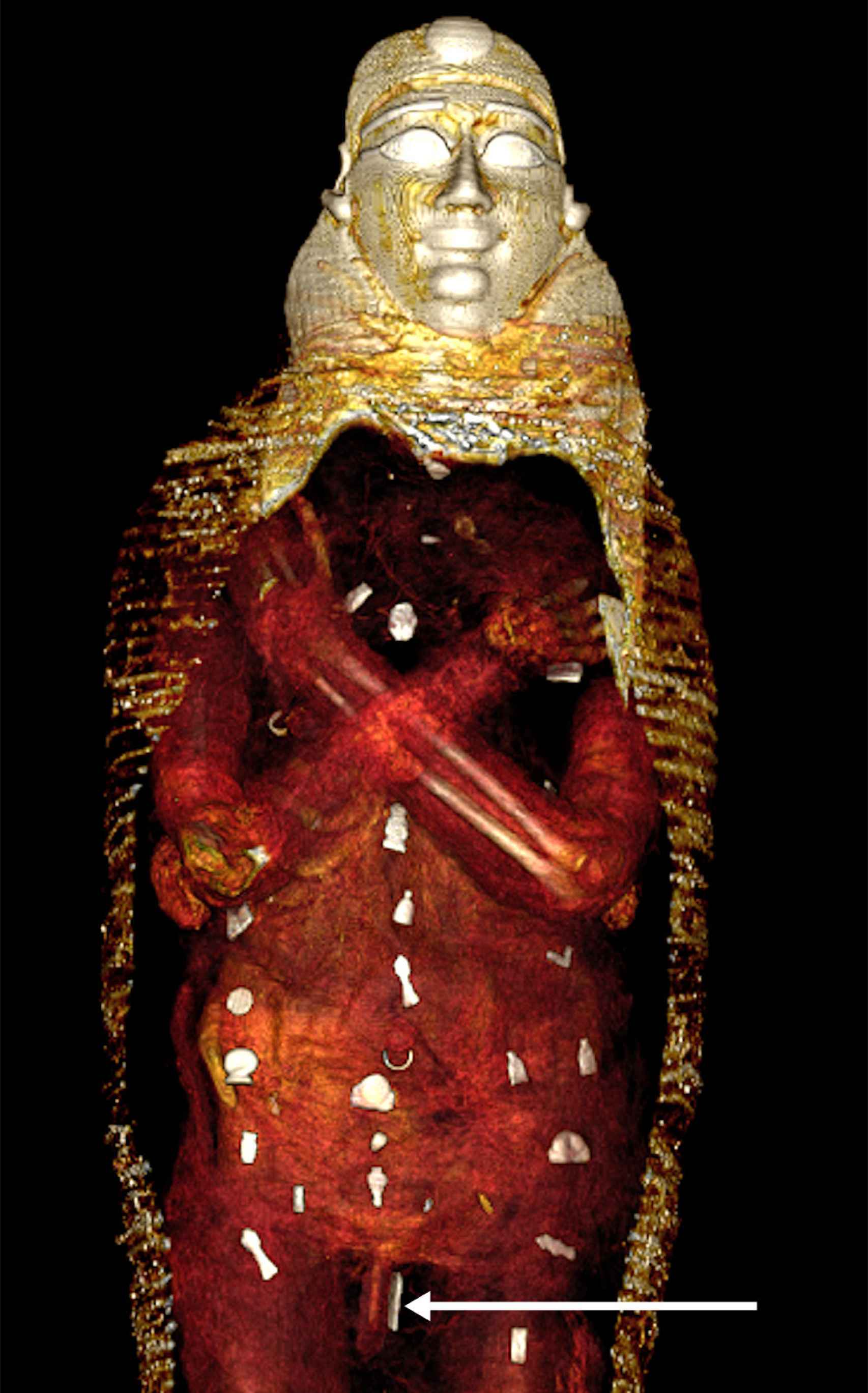 Distribution of objects in the body of the mummy.