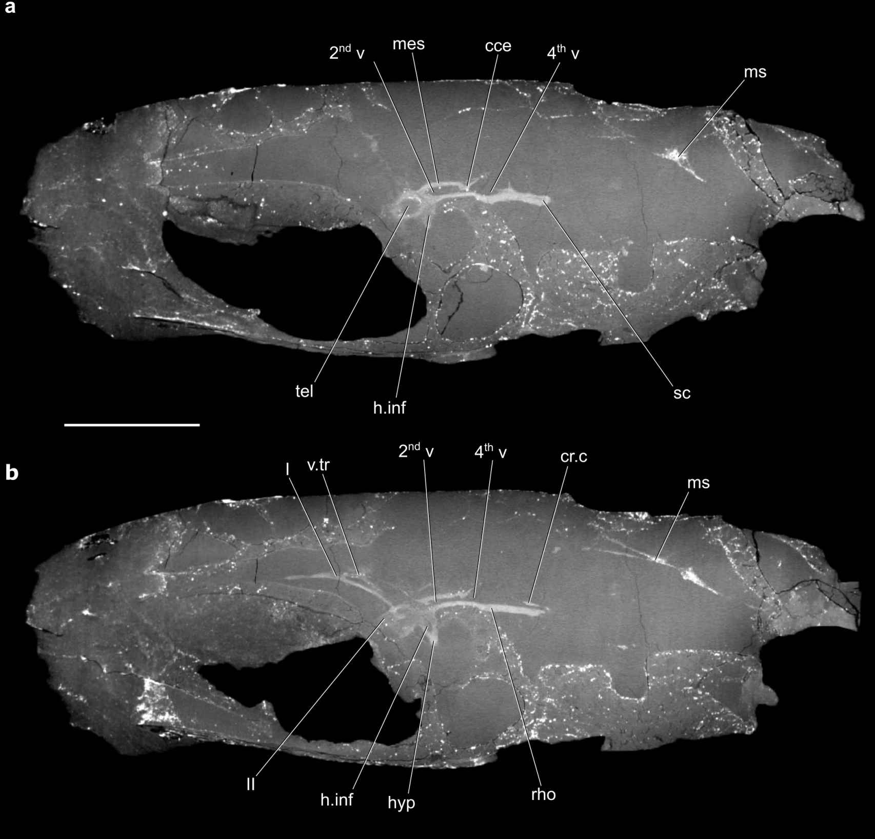 Escáner del fósil del Coccocephalus wildi en el que se destaca el cerebro preservado. Figueroa et al. en Nature, Febrero 2023